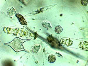 Plancton al microscopio-Isla Santa Clara